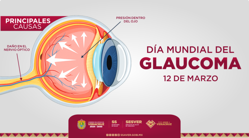 Cuidar la visión es cuidar tu calidad de vida